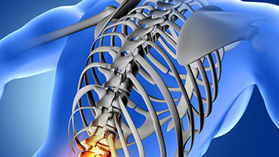 Dolor lumbar agudo