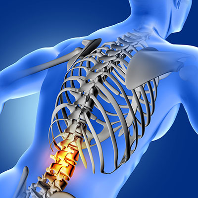 Dolor lumbar agudo